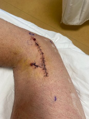 Bungalova tatile gitti, hayatı alt üst oldu