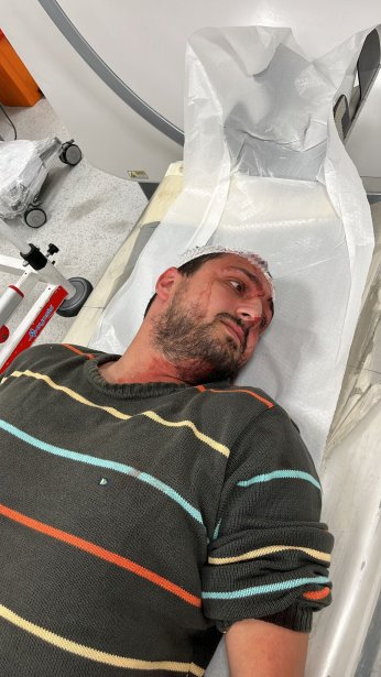 Otizmli genç fırında darbedildi