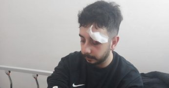 Voleybolculara taraftarlar saldırdı: 3 sporcu yaralı