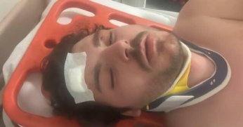 Trafikte darp edilen oyuncu dehşet anlarını anlattı