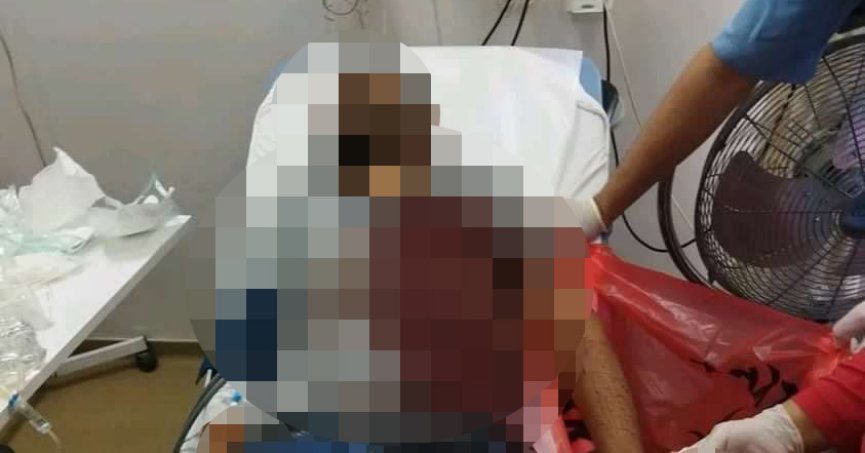 Elektrik sayacı okuyan personele köpek saldırdı