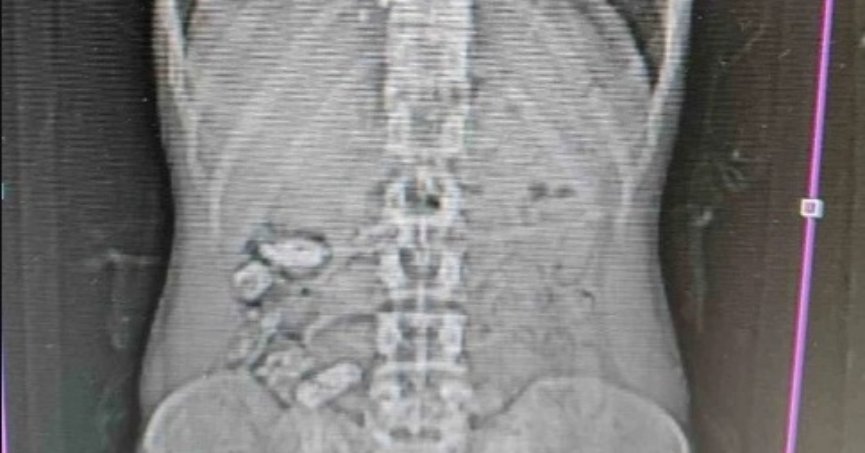 Uyuşturucu kuryesinin feci ölümü