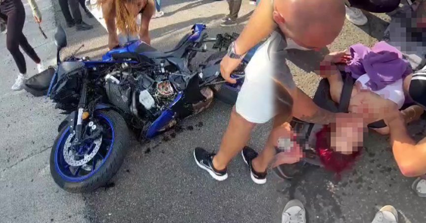 Motor kazasında kızın kolu kopma noktasına geldi