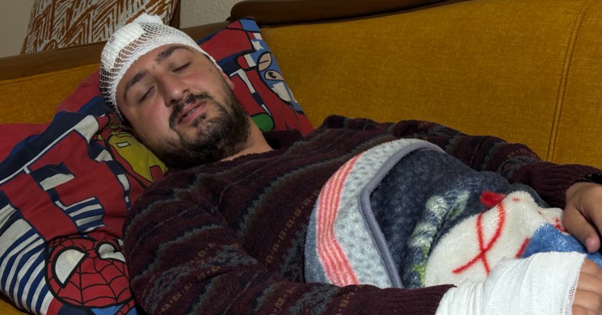 Otizmli genç fırında darbedildi